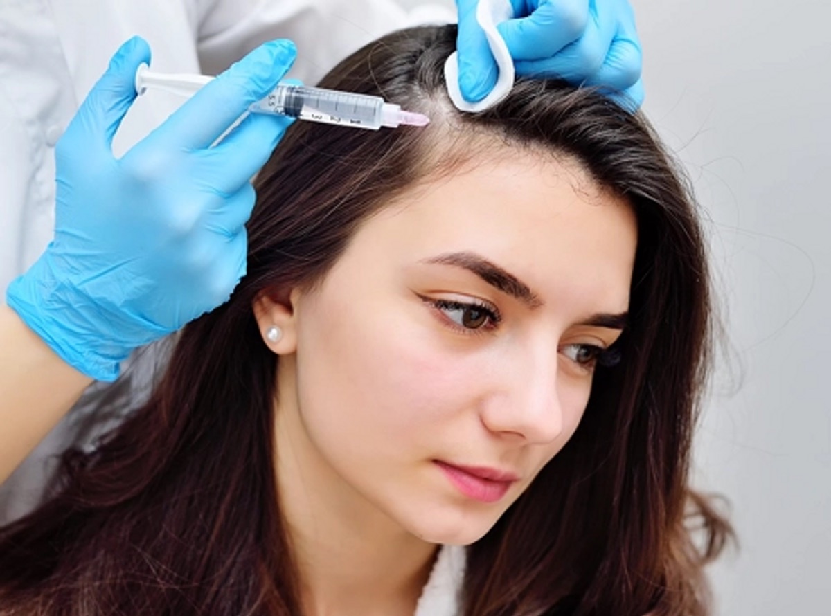 Hair Loss Treatments